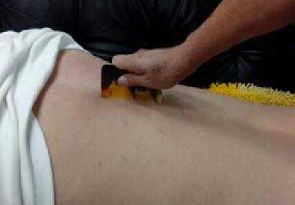 中医治疗卵巢早衰有哪些优势